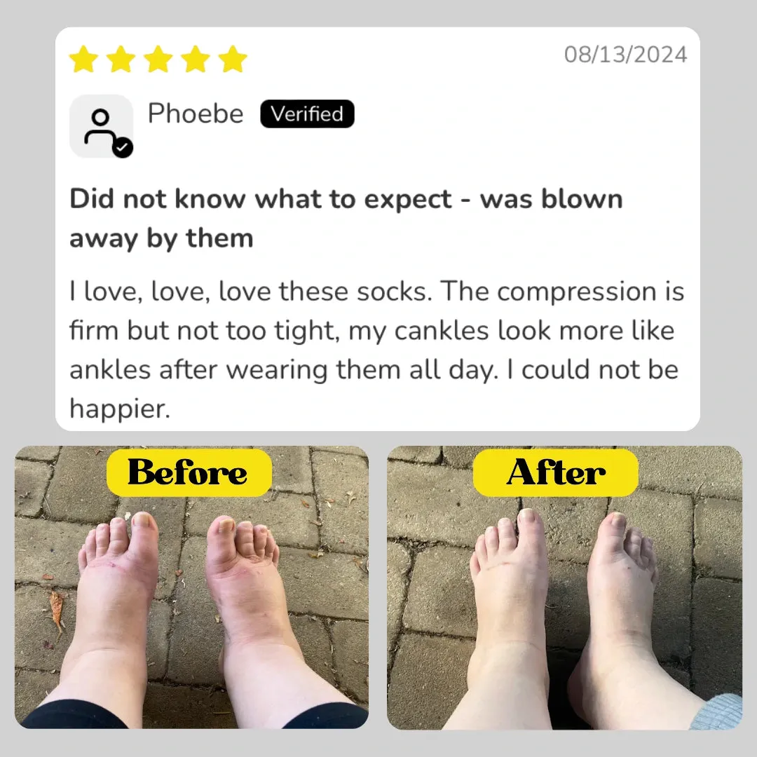 Classic Nude Compression Socks